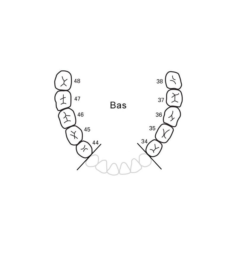 24 coussinets dentier bas