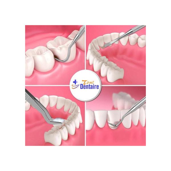 KIT DE DETARTRAGE DES DENTS