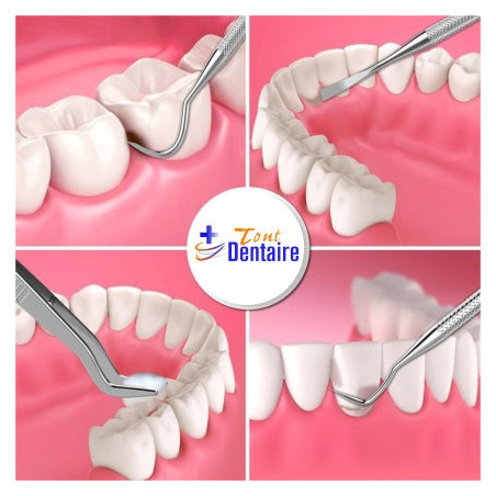 KIT DE DETARTRAGE DES DENTS