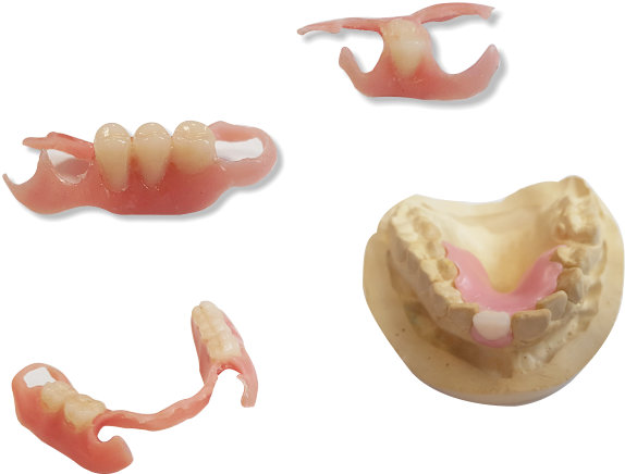 exemple-stelidont-unit dentaire