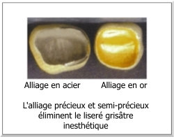 céramo-métallique alliage