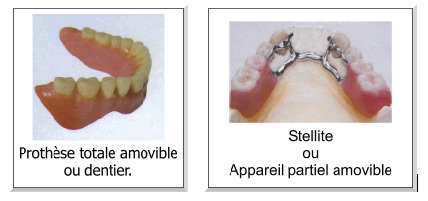 Dentier complet et partiel