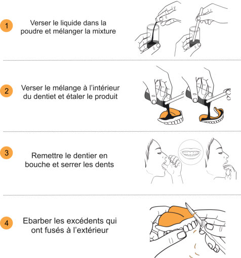 Colle dentaire longue durée AJUSDENT 1 an pour les dentiers