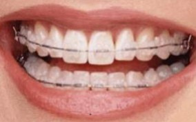 Les secrets de l'orthodontie dévoilés 