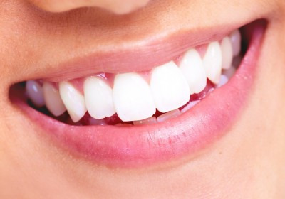 Un sourire éclatant et des dents blanches, comment faire ?